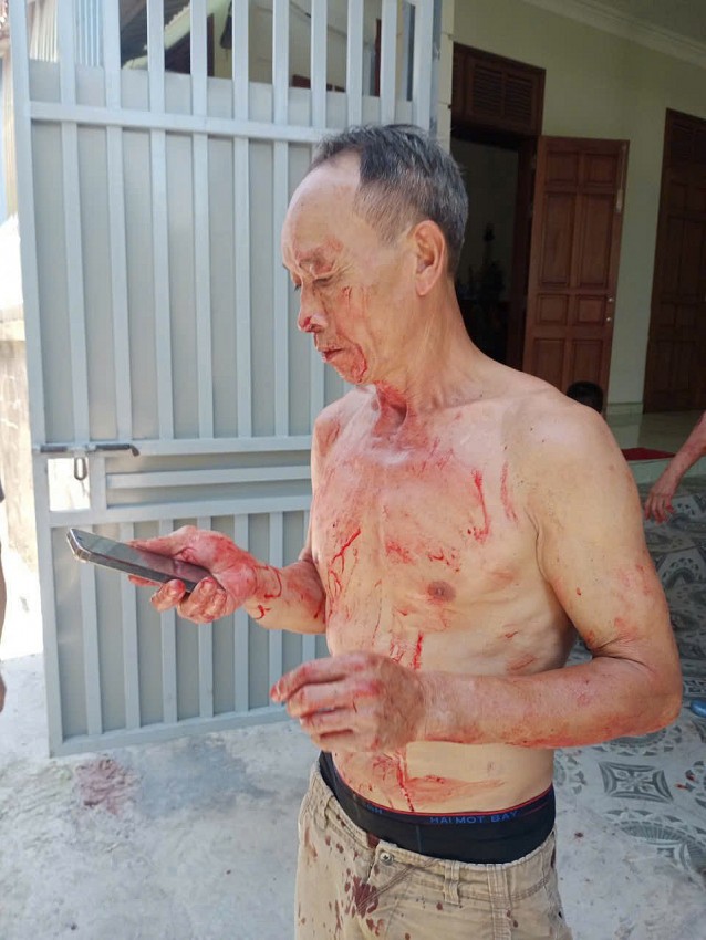 Hải Phòng: Người dân phải nhập viện khi nhắc nhở lò giết mổ lợn gây ô nhiễm