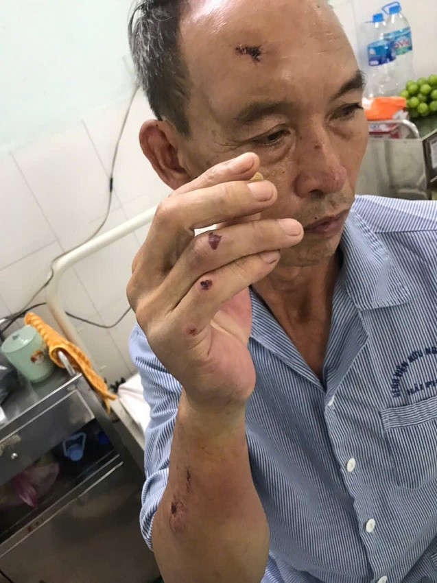 Hải Phòng: Xô xát với chủ lò mổ lợn khiến một người dân phải nhập viện