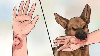 Lâm Đồng khẩn trương triển khai các biện pháp phòng, chống bệnh Dại tại địa phương nguy cơ cao